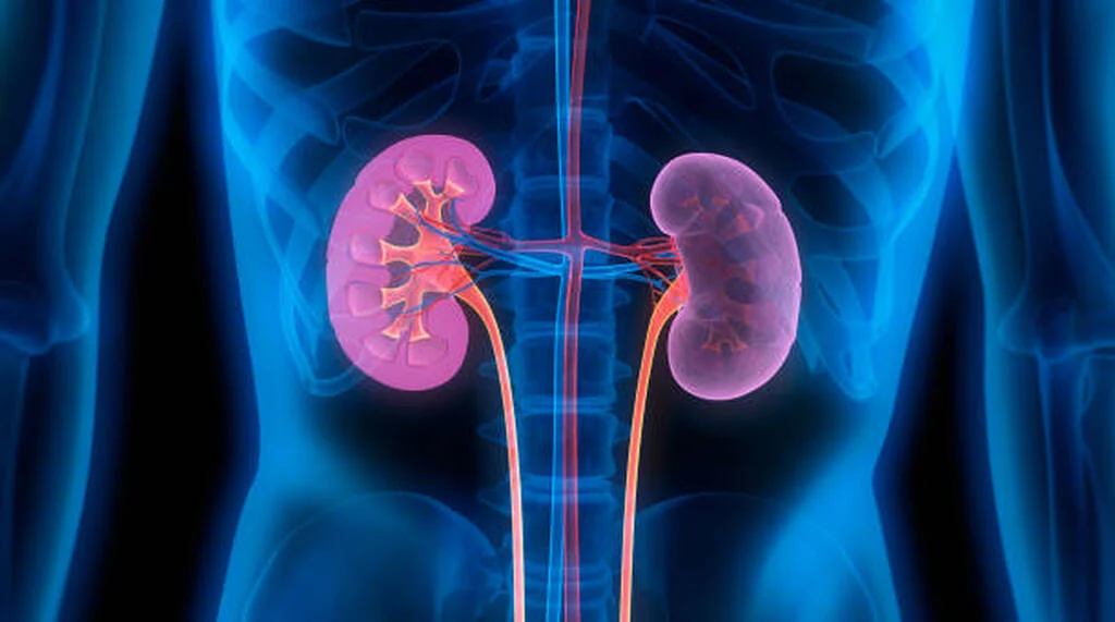Laparoscopic (Closed) Kidney Cancer Surgery
