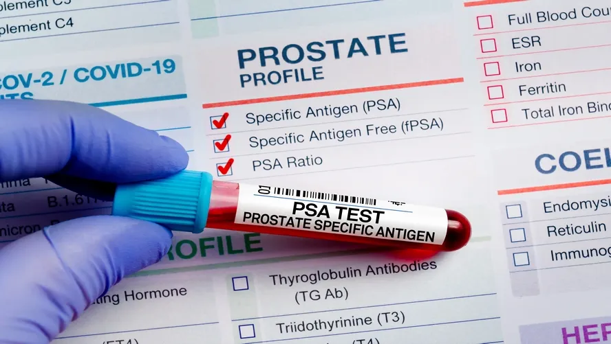 What is PSA Test? What Does Elevated PSA Mean?
