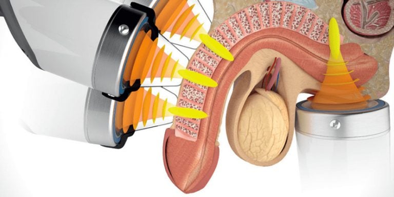 Erection Problem Treatment: Causes and Solutions